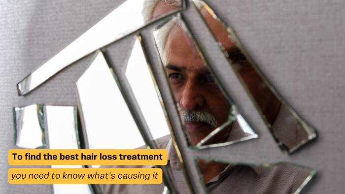 Treatments for hair thinning