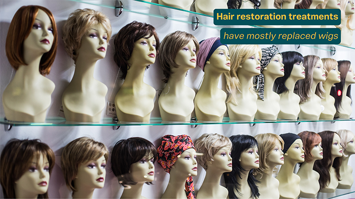 Wigs and hair systems can be used for extreme late stage balding