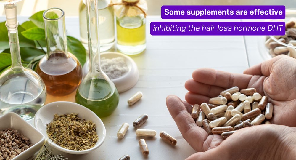 Hair loss supplements