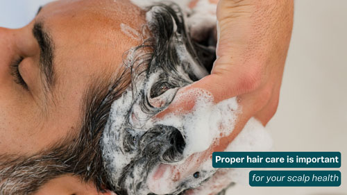 Hair care is important for scalp health